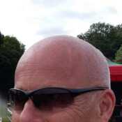 Allan 