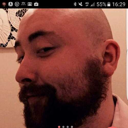 Baldnbearded7