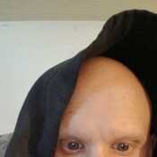 Baldguy